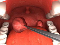 9. Surgery Simulator 2011 (PC) DIGITAL
