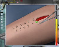 5. Surgery Simulator 2011 (PC) DIGITAL